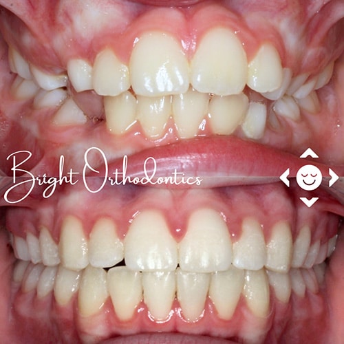 Before-After-1
